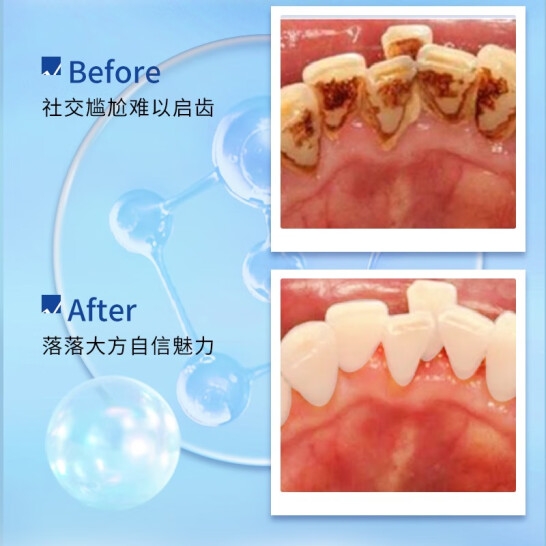 牙博士小苏打去渍美白牙膏40g